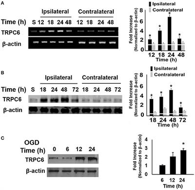 Deletion of TRPC6 Attenuates NMDA Receptor-Mediated Ca2+ Entry and Ca2+-Induced Neurotoxicity Following Cerebral Ischemia and Oxygen-Glucose Deprivation